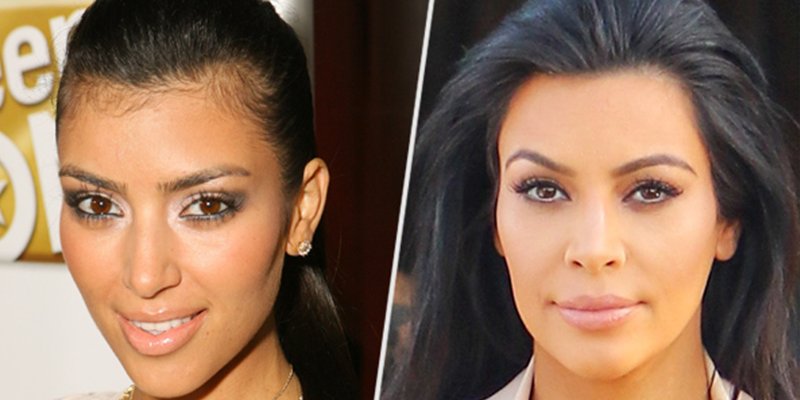 People No Twitter Kim Kardashian Reveals All Her Laser Hair Removal Secrets I Had Such A Hairy Neck Https T Co 0womzc5gtp Https T Co Z12rvltv0s Twitter People No Twitter Kim Kardashian Reveals All Her Laser Hair Removal Secrets I Had Such A Hairy Neck Https T Co 0womzc5gtp Https T Co Z12rvltv0s Twitter