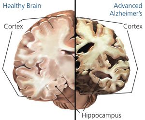 vrethics's tweet photo. #Porn caused ED, we made a pill to help. #VR will damage the brain structure in ways no pill can fix https://t.co/jMDujn73sA