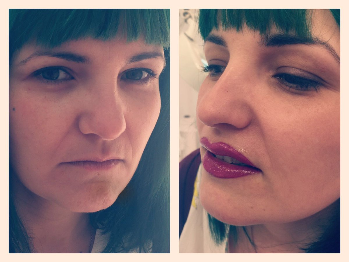 Micropigmentacion  a <a href="/nuryinblack/">Nuria Ruiz</a>  !! Labios con más rubor ,definidos y grandes sin cirugía