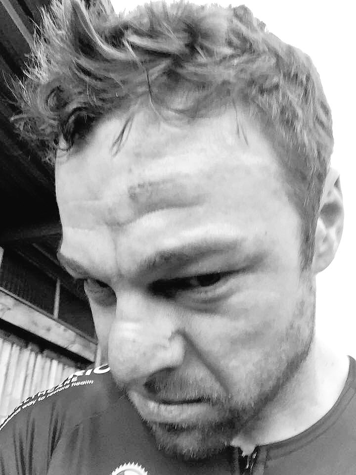 SaddleDrunk's tweet photo. 2 Top 10 finish last night #race &amp; 1 to #hospital Well done Kev!#SDRacingTeam @W5Physio @BlackIncWheels @KuaiSports https://t.co/pxMJ3A6xQK
