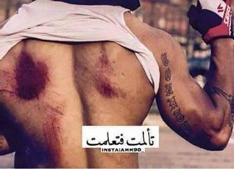 اموت انى سهر عالاقل انت التعيش
وعس،جف المكابر لو رحت يقصر 
ولا تزعل على الرادك اظل اوياه 
يحجي بدون وعيه لبي محل غزر