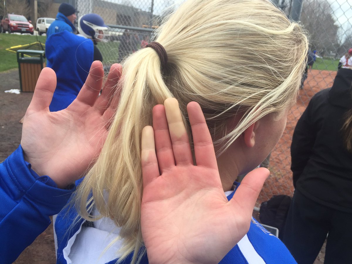 AllyRoRosa's tweet photo. Good thing my fingers were the same color as Sam's hair :) #RaynaudsProbs https://t.co/2DO7kMNO9J