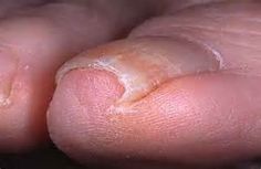 OttFootPractice tweet picture