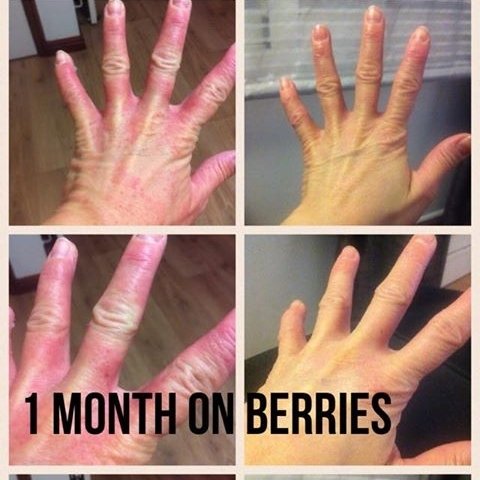 1 month on our berry capsules 💊💊 AMAZING