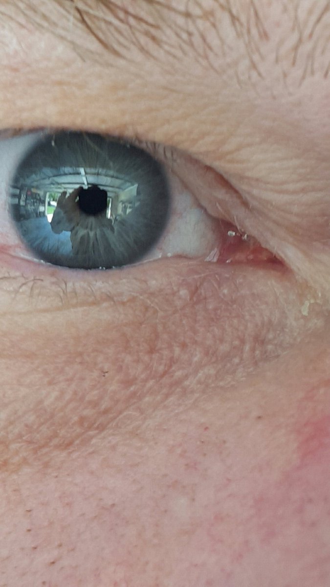 RSGarza64's tweet photo. Worry divides the mind. #worry  #divides #mind #EYES #magnifier  #NotesFromTheCheapSeats https://t.co/VFre8A0O6Q