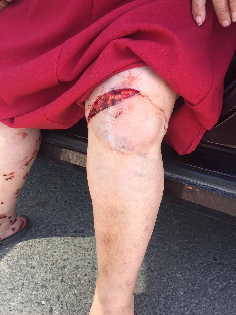 neillangevin's tweet photo. 72 yr old doing her recycling tripped at the Westside recycling area, @LethbridgeCity save our seniors,curbside #yql https://t.co/1twuqUilOi