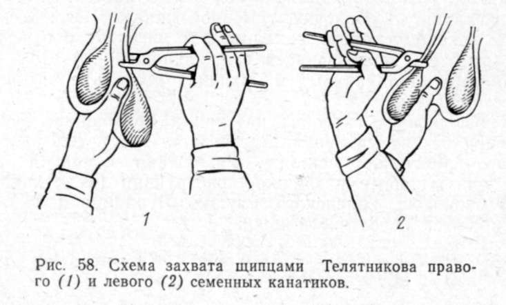 Химическая кастрация людей. Кастрация Бычков щипцами Телятникова:. Бескровная кастрация Быков. Щипцы Телятникова для кастрации Быков. Кастрация щипцами Телятникова.