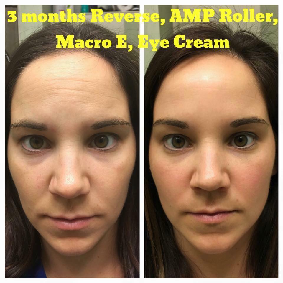 RyanInMiddle's tweet image. EVERYONE deserves to have their BEST skin! Msg me/comment below to learn more/request a "Glow Pack" sample. #rfrocks