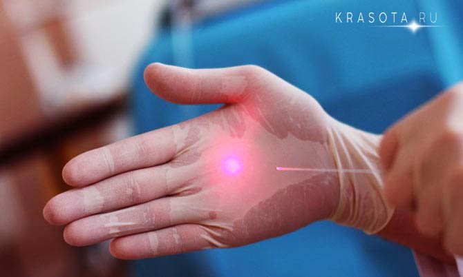 #болезнь_вен 
Подробнее: krasota.ru/posts/koagulya…
#красота_ру #женщина #здоровая_кожа #здоровье #здоровое_тело #кожа