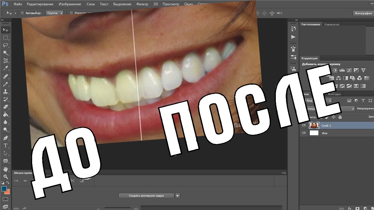 Скачать фотошоп с отбеливания зубов Скачать фотошоп с отбеливания зубов чем заменить ингалятор для детей