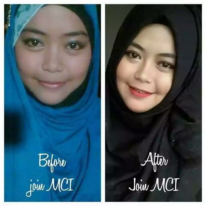 sela_nasya's tweet photo. Mb syifaaaaa....
Sblum dan sesudah knal produk MCI.. https://t.co/Ieg22cRKHM
