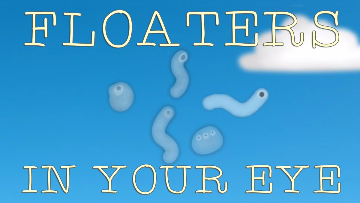 TED_ED's tweet photo. Have you ever noticed something floating across your field of vision? https://t.co/kA7QNz639n https://t.co/5qoplfsBd4