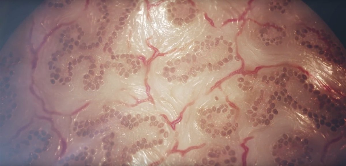 Printable Organs are Closer Than Ever Thanks to 3 Bioprinting Breakthroughs bit.ly/1ScEIH4