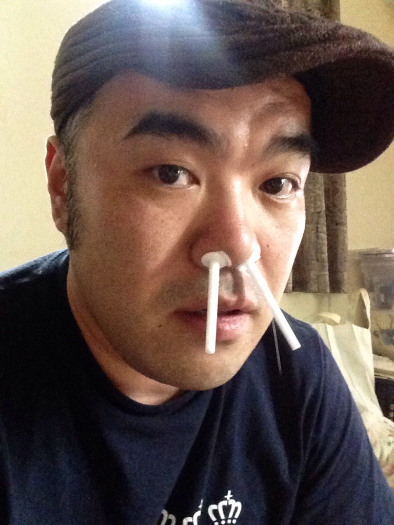 ken_m614's tweet photo. 固めたワックスでゴッソリ鼻毛を抜くキットを購入。
これから一気に引っこ抜きます。 https://t.co/YY66vhnuVP