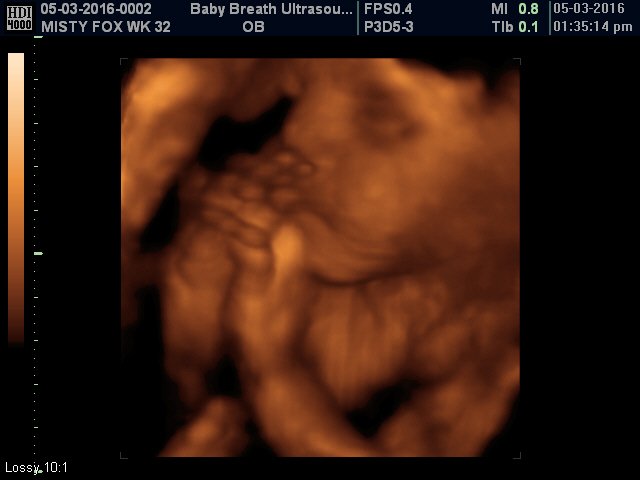 3d Baby Ultrasound breath1 Twitter