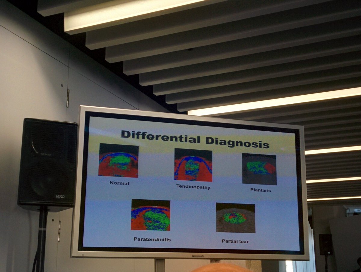 <a href="/UTC_imaging/">UTC Imaging</a> <a href="/lorenzo_masci/">Lorenzo Masci</a> #RTP2016