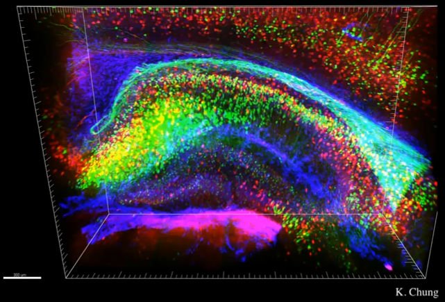 mujerconciencia's tweet photo. Un retrato neuronal de la mente humana
Una conferencia de Nancy Kanwisher en #ted2014
https://t.co/LoHqqVNSlY https://t.co/zFj0yHKr4g