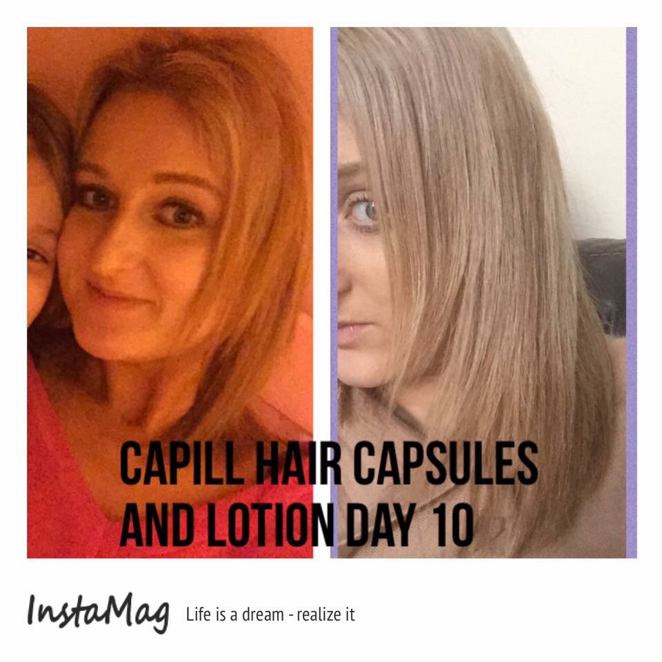 sbakesy85's tweet photo. Love love love this product😍#capillhairkit #capill #healthy #long #growth #strong #hair #blonde #beautiful #ActiLabs https://t.co/IsZmPrrdrf