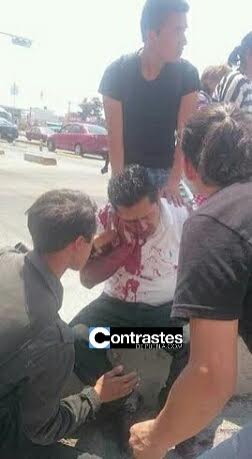 avigail772's tweet photo. Uno De Los Dos Heridos De La Balacera En La Capital Poblana.
#PueblaInsegura... https://t.co/1LXYbzDmFH