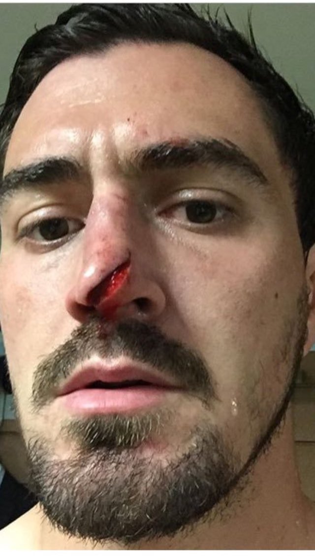 stanstfoy's tweet photo. Oh merde heureusement qu'il avait le nez!!!😬😬😬 #RACRCT https://t.co/1DnjONNUC3
