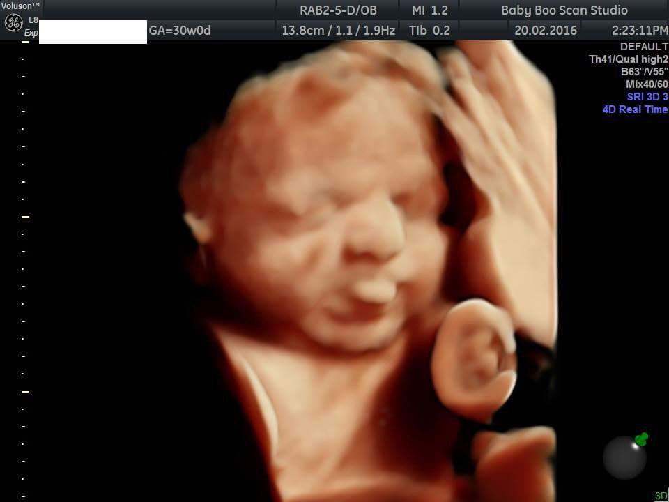 BabyBooScan's tweet image. Pulling tongues at us #4dscan #pregnant #baby #lancashire #Cumbria #manchester