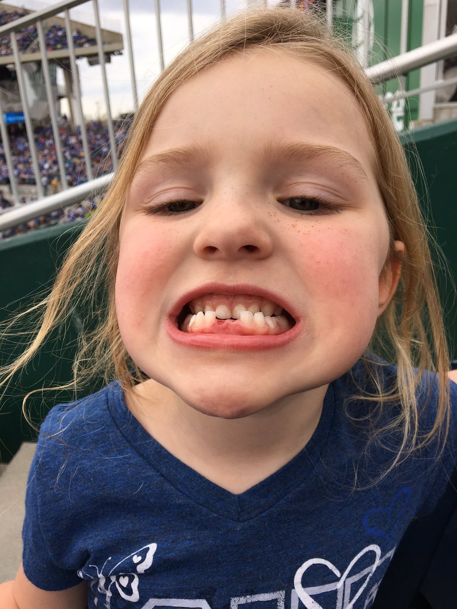 CDBEATS's tweet photo. @FSKansasCity @royals @RexHudler1 @goldbergkc - Lost 2 teeth today at the royals game. Good Luck? Let's Go Royals! https://t.co/JlPFLLM8ww