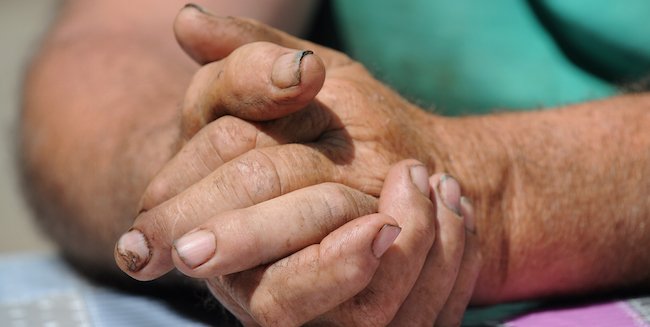 MensHealthMag's tweet photo. Your nails make a bigger impression than you think. https://t.co/dywvMhV5wx https://t.co/n8eBJKI8kK