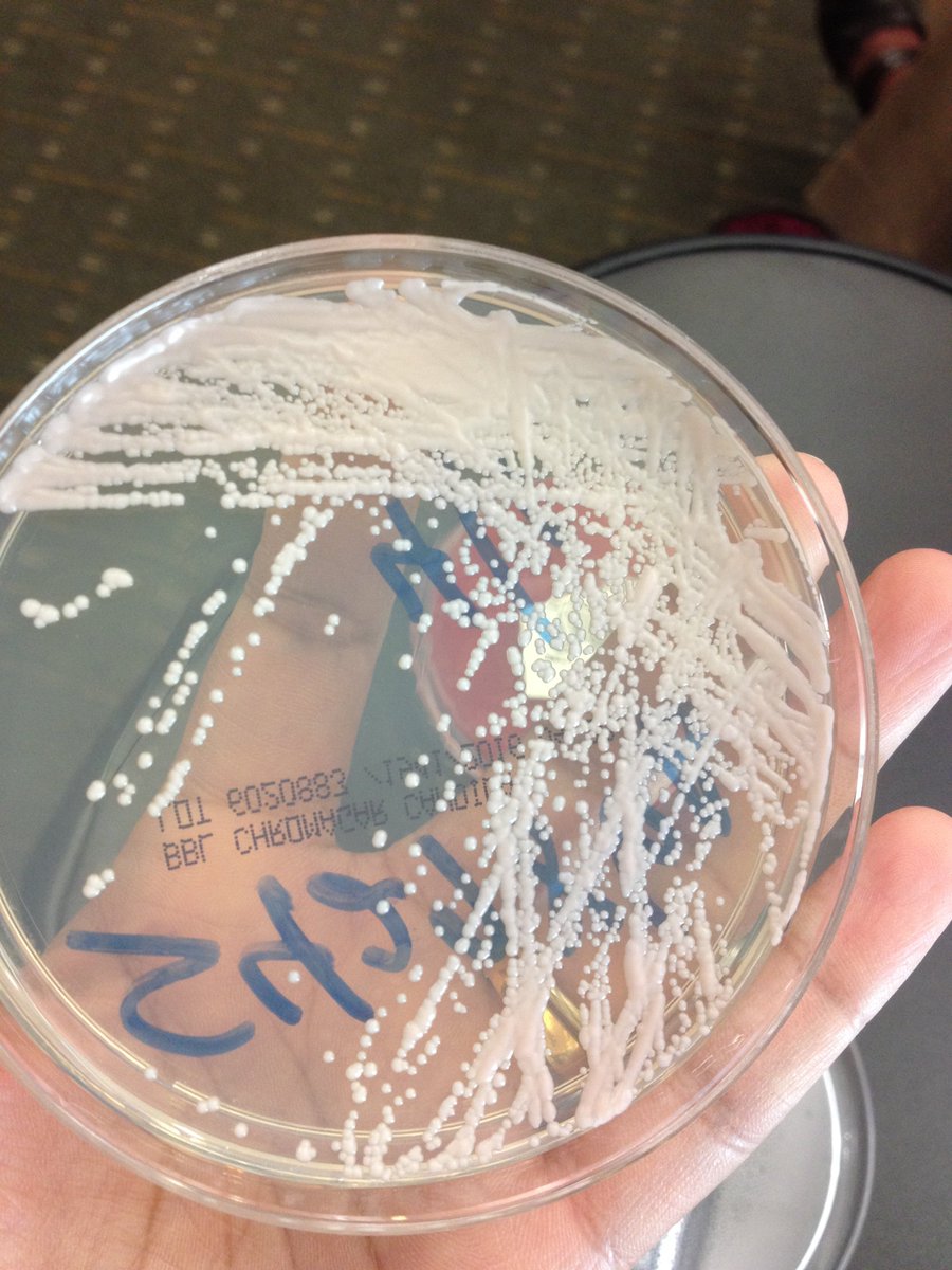 LSUHSCID's tweet photo. Picture quiz1: AIDS pt BCx w/budding yeast. Serum Crypto Ag negative.  Chromagar is mauve. What is this? https://t.co/Rl0CmmaXFw