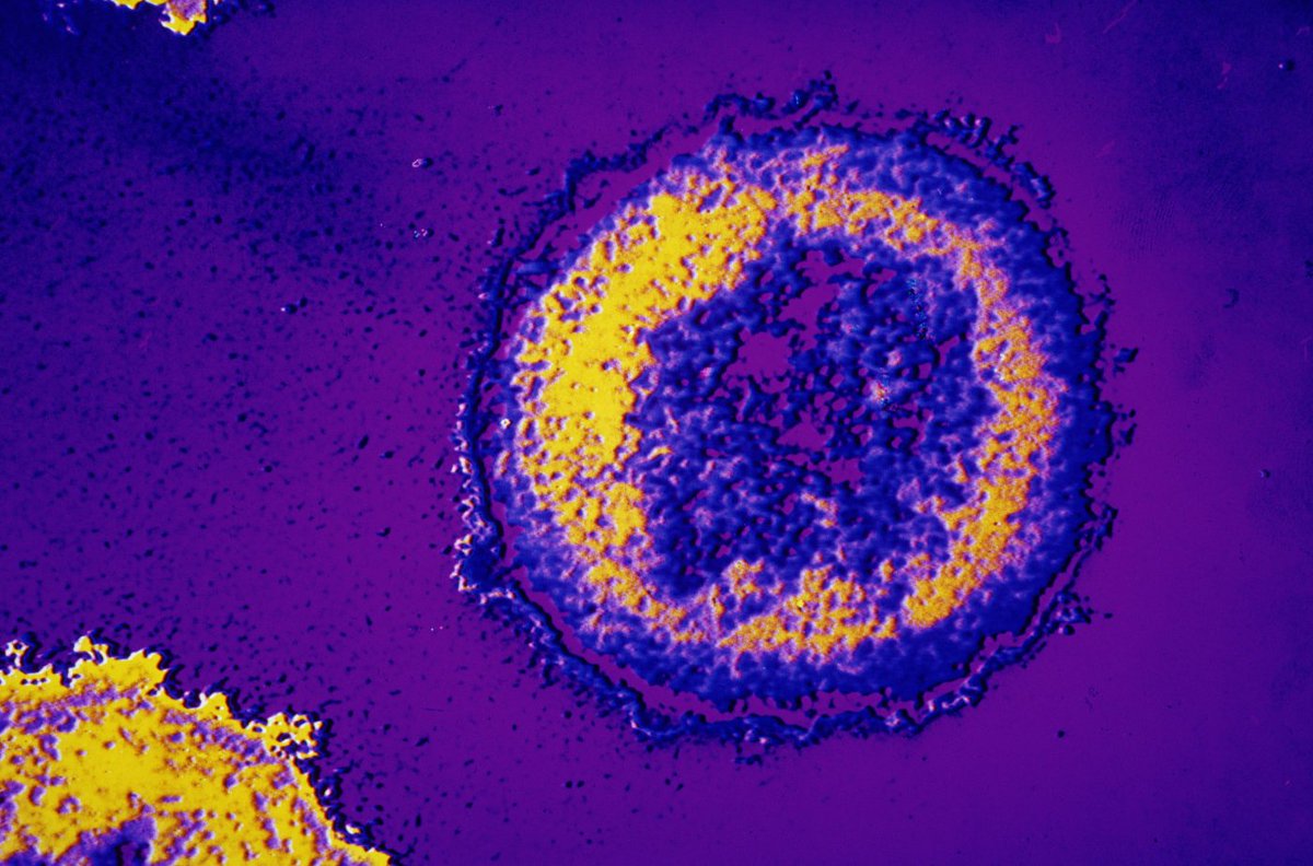TransAfrica872's tweet photo. HIV resists attempts to cripple it with gene editing. https://t.co/FQICmlOrDJ #Dstv872 #StayAfrican https://t.co/JqPlxrS9HR