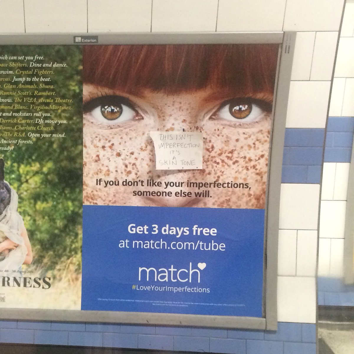 apologises for ads that label freckles as 'imperfections