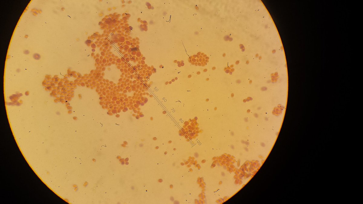 KWPoole97's tweet photo. Bacteria found in yogurt 1.5 weeks and yogurt reference sample @MMCBiology https://t.co/qmw0dREOZ5