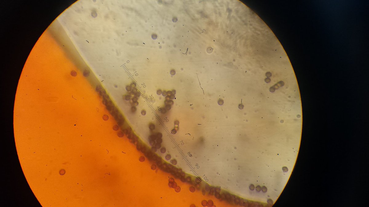 KWPoole97's tweet photo. Bacteria found in yogurt 1.5 weeks and yogurt reference sample @MMCBiology https://t.co/qmw0dREOZ5
