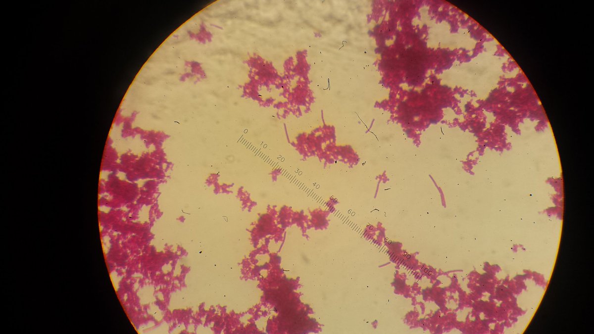 KWPoole97's tweet photo. Bacteria found in yogurt 1.5 weeks and yogurt reference sample @MMCBiology https://t.co/qmw0dREOZ5