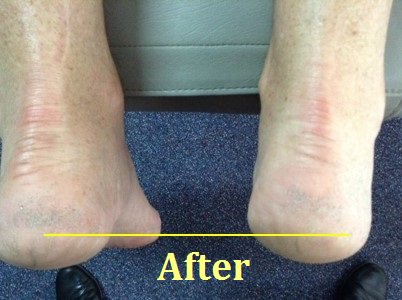 drChangHealth's tweet photo. Do I really have a Short Leg?  https://t.co/vcqIuPPJtO
 #drchanghealthlajollashores #movewellfeelbetterlookgreat https://t.co/PUB9b0jXkt