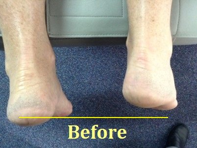 drChangHealth's tweet photo. Do I really have a Short Leg?  https://t.co/vcqIuPPJtO
 #drchanghealthlajollashores #movewellfeelbetterlookgreat https://t.co/PUB9b0jXkt