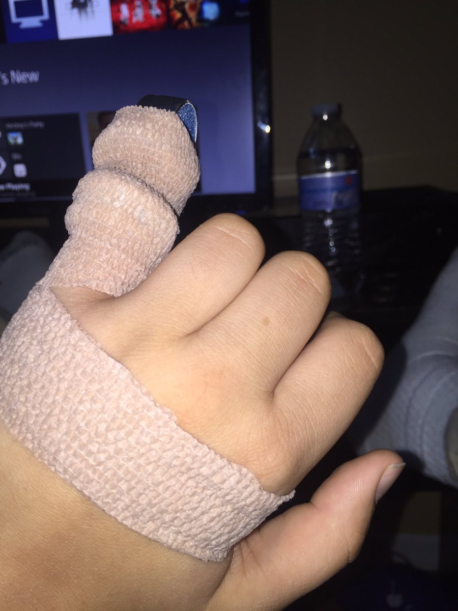 SClimates's tweet image. Broken finger doesn't stop the grind 😂😂😂