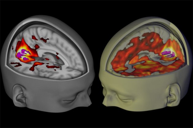 Brains scans reveal how LSD affects consciousness bit.ly/1S1w0fB