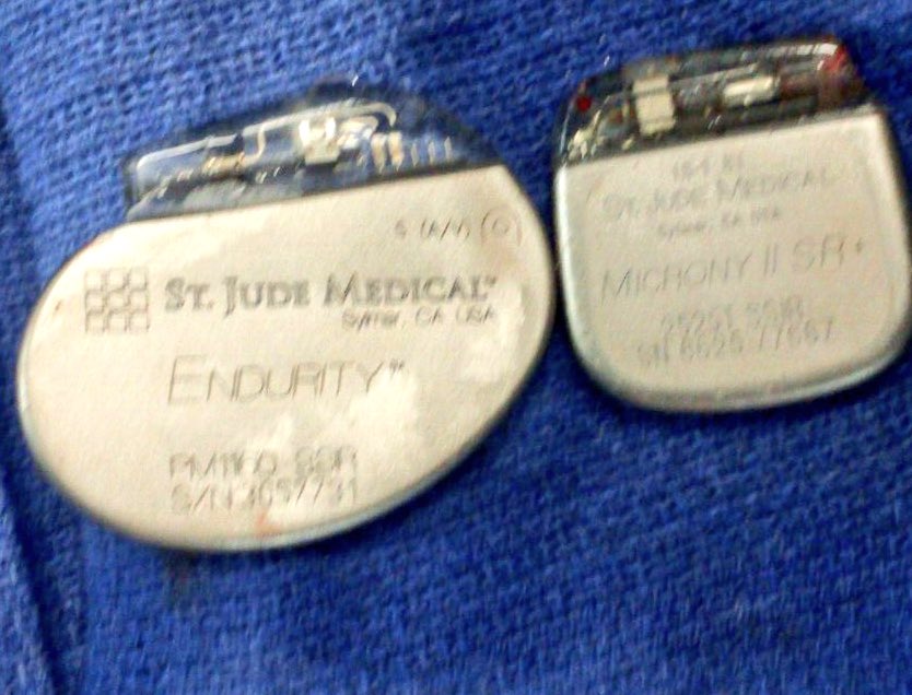 manuelpatete's tweet photo. when the old technologist is smaller than the new #Vintage #Microny #endurity #pacemakers https://t.co/w8pEw8hKNg