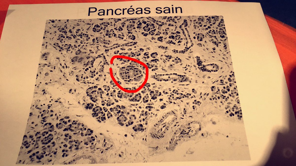 Clndorian's tweet photo. Voici un îlot pancréatique chez un pancréas sain. #diabetdorian https://t.co/ZR3GMi4AS6