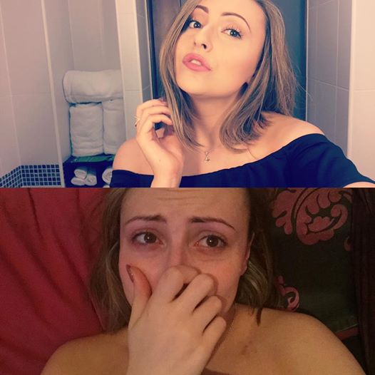 This woman took before and after pics to show the reality of panic attacks bzfd.it/25VyK7O