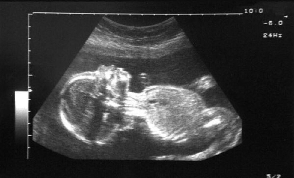 Throwback to my last decent sleep