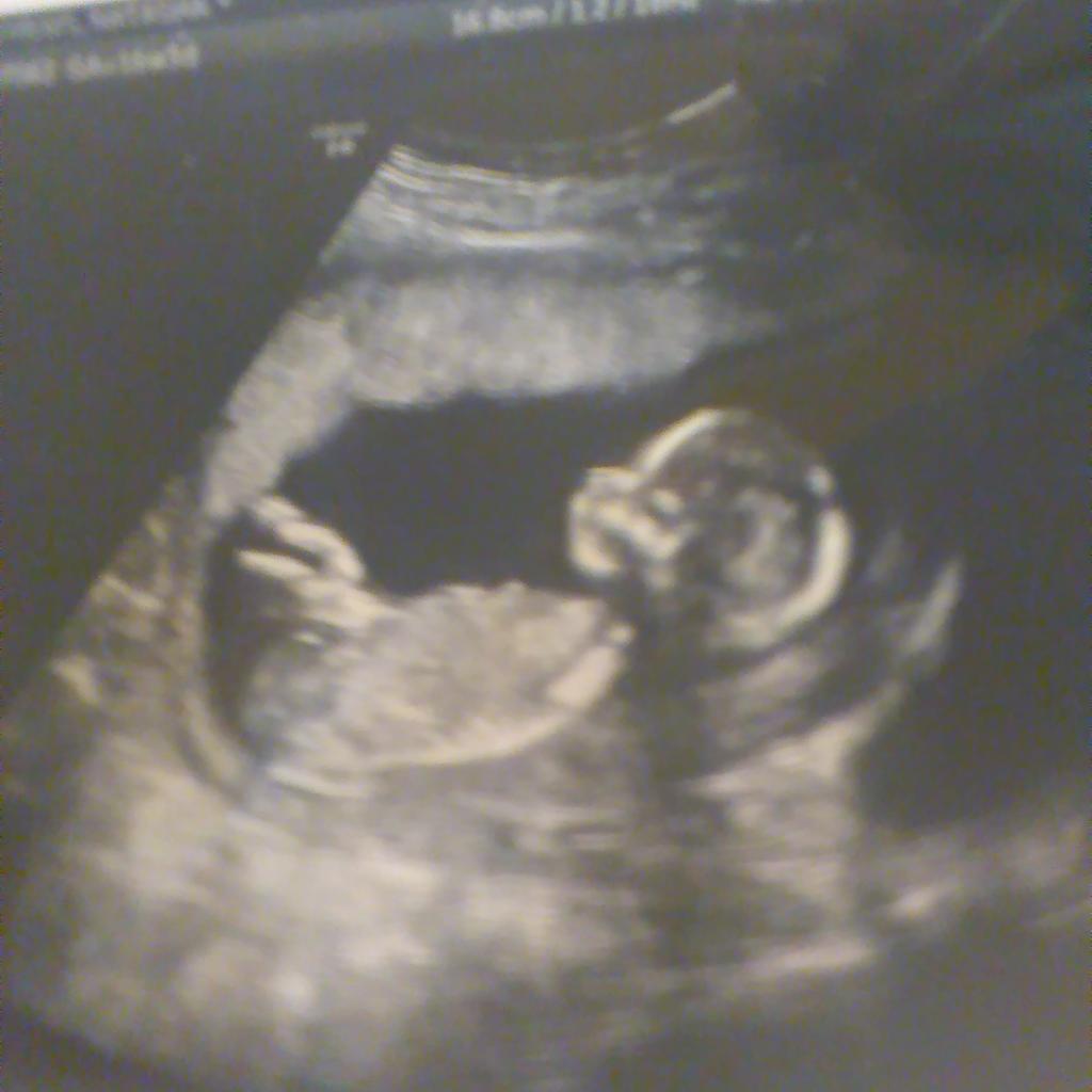 buzzkill0802's tweet image. It's a boy!
