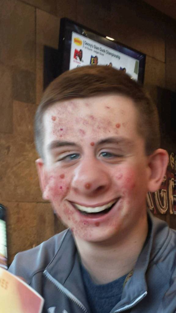 klaybyker's tweet photo. He has no hygiene.. #typicalandy https://t.co/4PsohbGscs