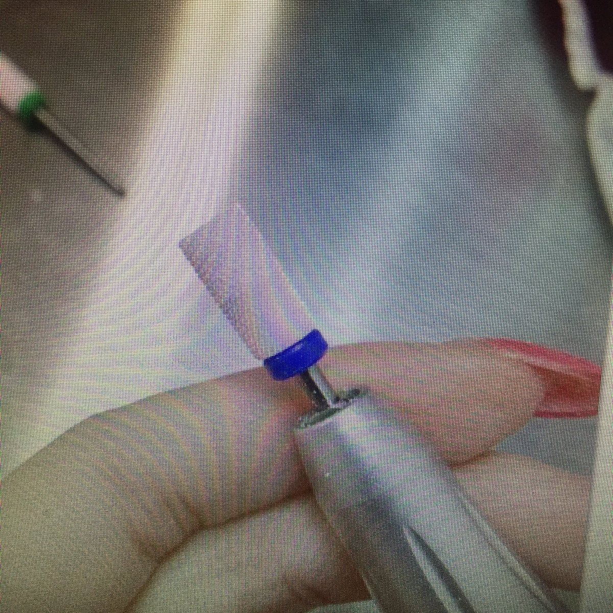 jason (@naildrillbits) on Twitter photo 