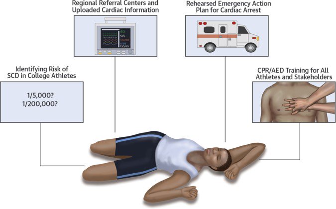 RevEspCardiol's tweet image. Consenso en atención cardiovascular en atletas universitarios #FreeScience @JACCJournals  ow.ly/4mPmPQ