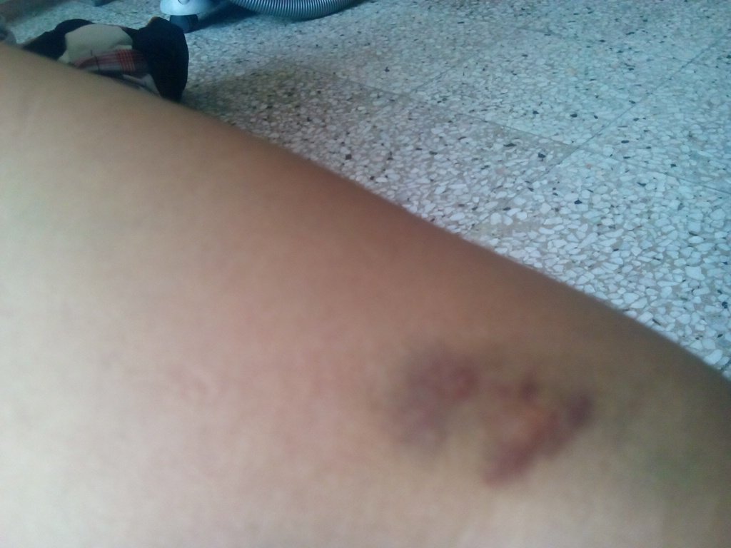 80 Hantu Gigit Terbaru