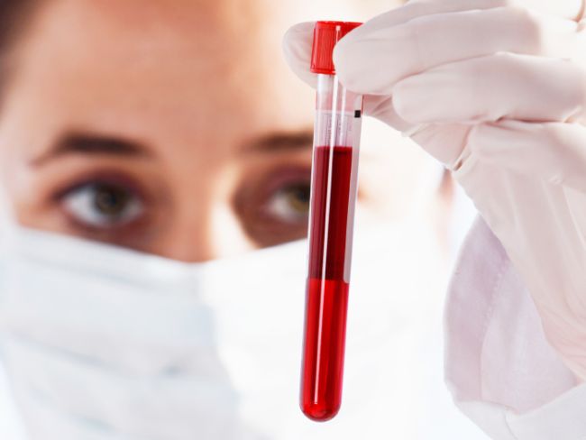 UnitedClinical's tweet photo. Some of our most common tests: #ChemistryPanel & #CBC, #Fibrinogen, #HemoglobinA1C, #DHEA, #PSA, #Homocysteine. https://t.co/99MtllZi77