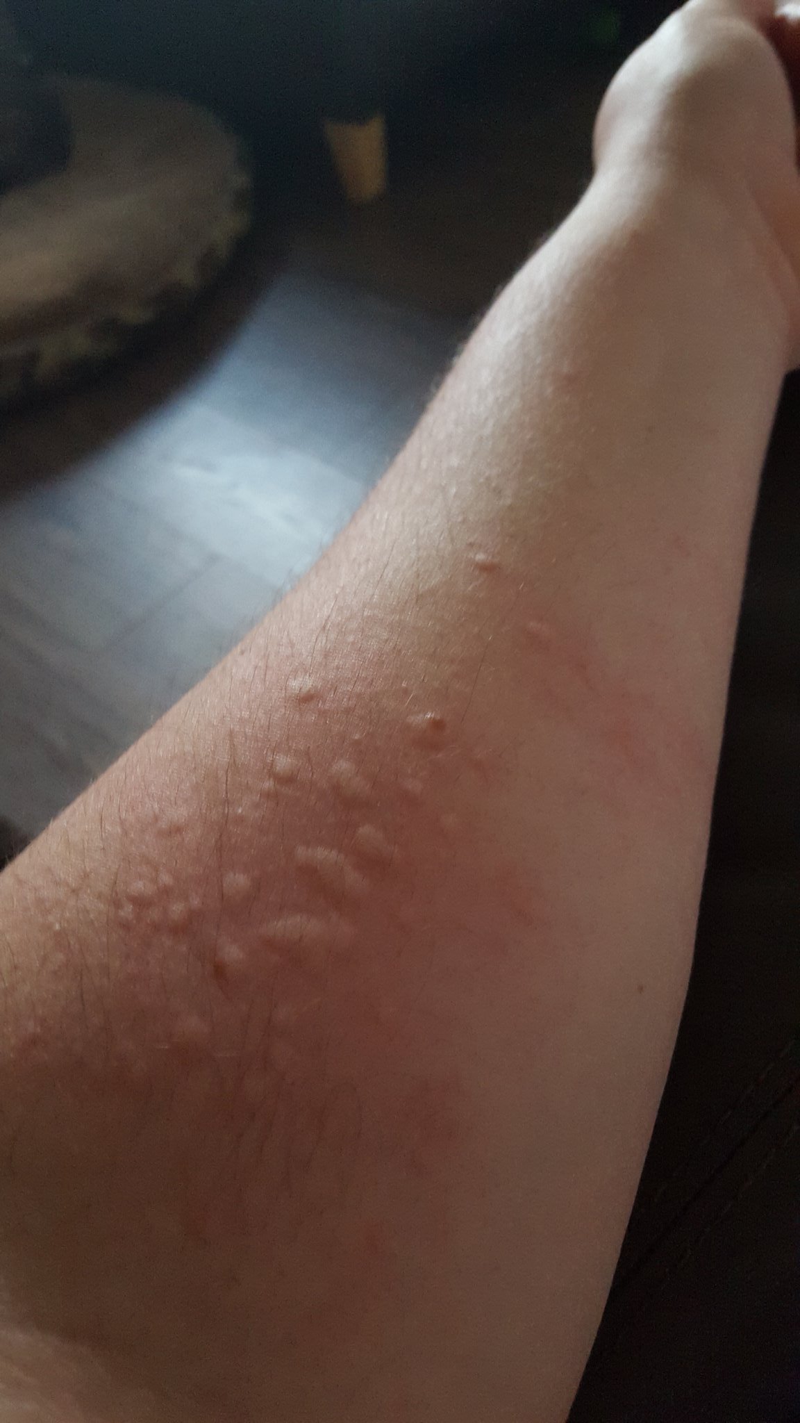 Dawn Pring On Twitter Allergic Reaction To My Dog Great Just Great Https T Co Eju52guduz Twitter