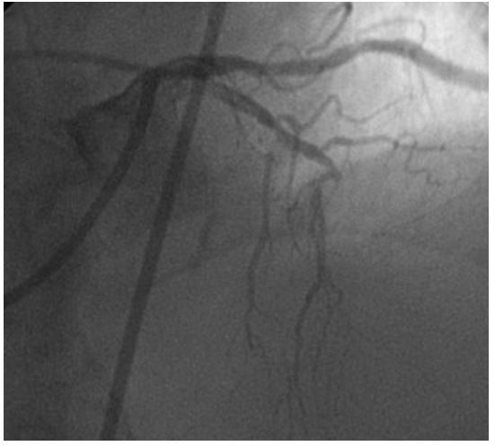 JeanMarcoMD's tweet photo. Reflecting together on assumptions or beliefs: a case of anterior #STEMI https://t.co/cdXDuJJQDw. Comments welcome https://t.co/tzgEeRFiH8