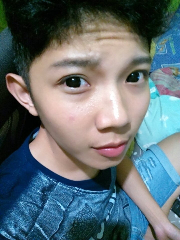 sebelum mandi persiapan jumatan pamer jerawat duluu..haaaa 😞😞😒😌😔😣😳